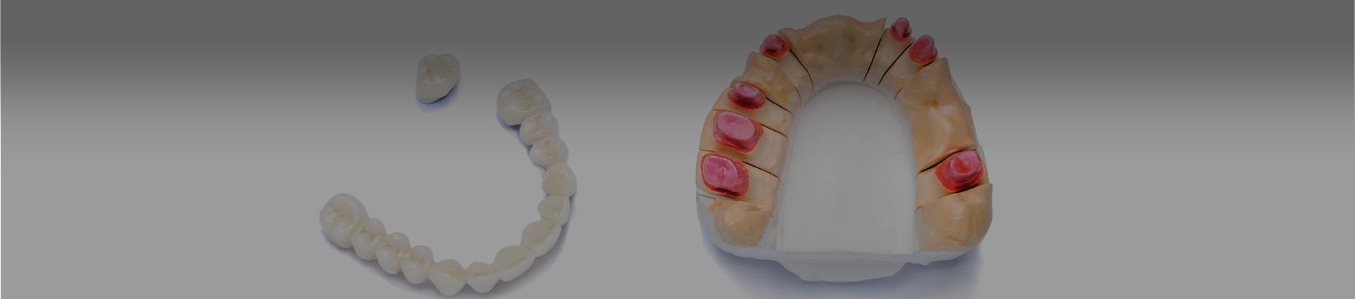układ zębowy model - Banner w kontakcie